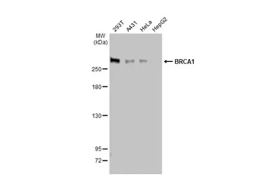 Anti-BRCA1 antibody used in Western Blot (WB). GTX70134