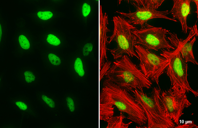 Anti-DNA ligase I antibody [10H5] used in Immunocytochemistry/ Immunofluorescence (ICC/IF). GTX70141