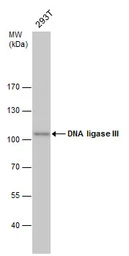 Anti-DNA ligase III antibody [1F3] used in Western Blot (WB). GTX70143