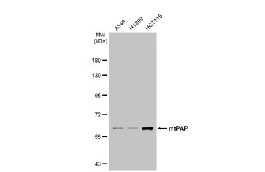 Anti-mtPAP antibody [1D3] used in Western Blot (WB). GTX70156