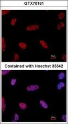 Anti-E2F1 antibody [10D1 2B5] used in Immunocytochemistry/ Immunofluorescence (ICC/IF). GTX70161