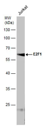 Anti-E2F1 antibody [16G7] used in Western Blot (WB). GTX70163