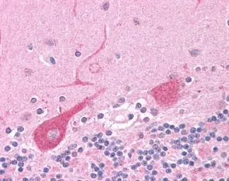 Anti-UBE3A antibody used in Immunohistochemistry (IHC). GTX70169