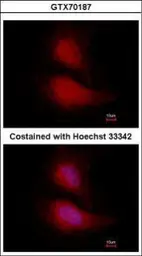 Anti-FOXO1 antibody [14E4] used in Immunocytochemistry/ Immunofluorescence (ICC/IF). GTX70187