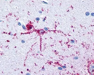 Anti-FOXO1 antibody [4E7] used in Immunohistochemistry (IHC). GTX70189