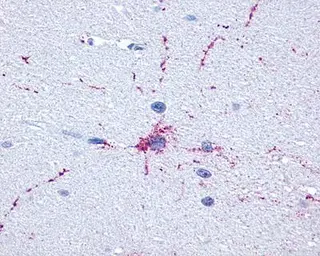 Anti-FOXO1 antibody [7H11] used in Immunohistochemistry (IHC). GTX70191