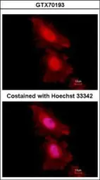 Anti-FOXO1 antibody [7H3] used in Immunocytochemistry/ Immunofluorescence (ICC/IF). GTX70193