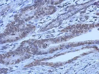 Anti-FOXO1 antibody [7H3] used in IHC (Paraffin sections) (IHC-P). GTX70193