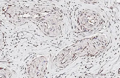 Anti-FOXO1 antibody [7H3] used in IHC (Paraffin sections) (IHC-P). GTX70193