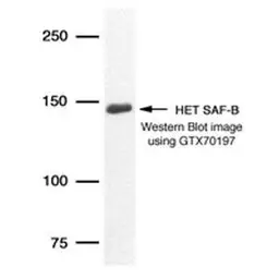 Anti-SAFB antibody [6F7] used in Western Blot (WB). GTX70197