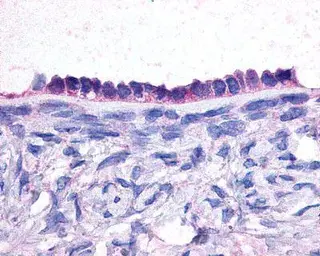 Anti-Jab1 antibody [6C3.38] used in Immunohistochemistry (IHC). GTX70205