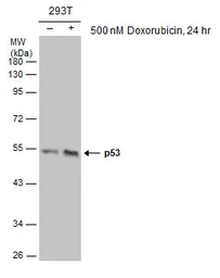 Anti-p53 antibody [DO1] used in Western Blot (WB). GTX70214