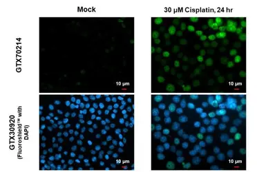 Anti-p53 antibody [DO1] used in Immunocytochemistry/ Immunofluorescence (ICC/IF). GTX70214