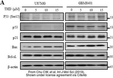 Anti-p53 antibody [Pab1801] used in Western Blot (WB). GTX70216