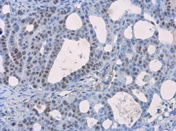 Anti-p53 antibody [Pab1801] used in IHC (Paraffin sections) (IHC-P). GTX70216