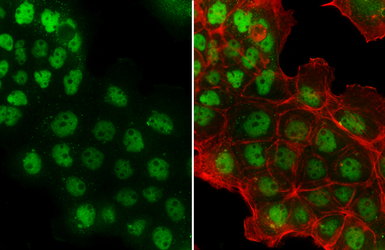 Anti-p53 antibody [Pab1801] used in Immunocytochemistry/ Immunofluorescence (ICC/IF). GTX70216