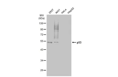 Anti-p53 antibody [Pab1801] used in Western Blot (WB). GTX70216