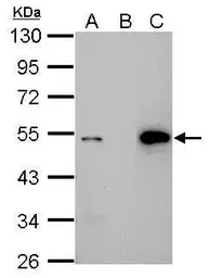 Anti-p53 antibody [Pab1801] used in Immunoprecipitation (IP). GTX70216