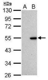 Anti-p53 antibody [Pab1801] used in Western Blot (WB). GTX70216