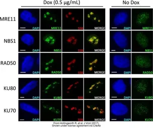 Anti-NBS1 antibody [1C3] used in Immunocytochemistry/ Immunofluorescence (ICC/IF). GTX70222