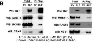 Anti-NBS1 antibody [1C3] used in Western Blot (WB). GTX70222