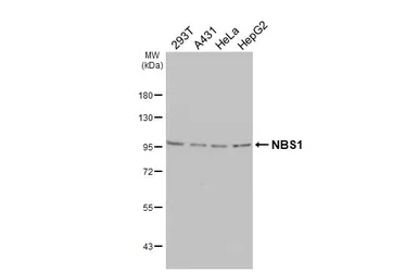 Anti-NBS1 antibody [1C3] used in Western Blot (WB). GTX70222