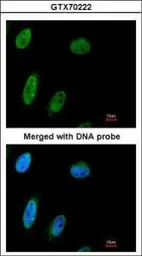 Anti-NBS1 antibody [1C3] used in Immunocytochemistry/ Immunofluorescence (ICC/IF). GTX70222