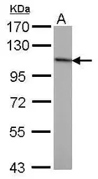 Anti-NBS1 antibody [1C3] used in Western Blot (WB). GTX70222