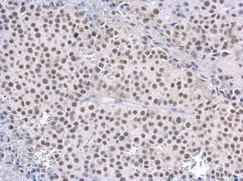 Anti-Rad50 antibody [13B3] used in IHC (Paraffin sections) (IHC-P). GTX70228
