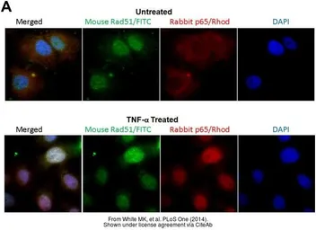 Anti-Rad51 antibody [14B4] used in Immunocytochemistry/ Immunofluorescence (ICC/IF). GTX70230