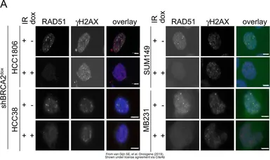 Anti-Rad51 antibody [14B4] used in Immunocytochemistry/ Immunofluorescence (ICC/IF). GTX70230