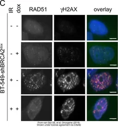 Anti-Rad51 antibody [14B4] used in Immunocytochemistry/ Immunofluorescence (ICC/IF). GTX70230