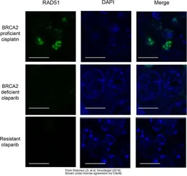 Anti-Rad51 antibody [14B4] used in Immunohistochemistry (IHC). GTX70230