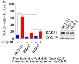 Anti-Rad51 antibody [14B4] used in Western Blot (WB). GTX70230