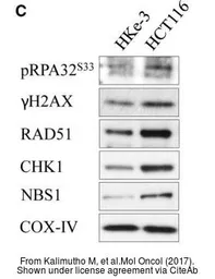 Anti-Rad51 antibody [14B4] used in Western Blot (WB). GTX70230