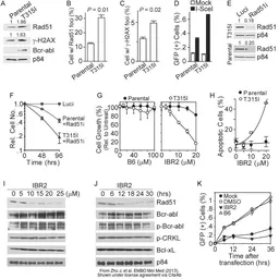 Anti-Rad51 antibody [14B4] used in Western Blot (WB). GTX70230