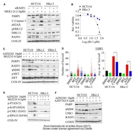 Anti-Rad51 antibody [14B4] used in Western Blot (WB). GTX70230