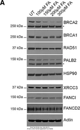Anti-Rad51 antibody [14B4] used in Western Blot (WB). GTX70230