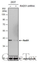 Anti-Rad51 antibody [14B4] used in Western Blot (WB). GTX70230