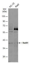Anti-Rad51 antibody [14B4] used in Western Blot (WB). GTX70230