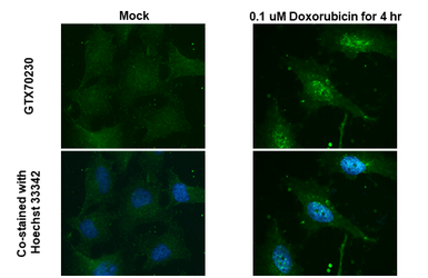 Anti-Rad51 antibody [14B4] used in Immunocytochemistry/ Immunofluorescence (ICC/IF). GTX70230