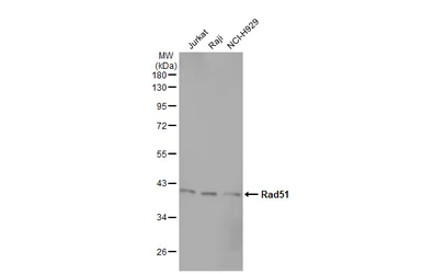 Anti-Rad51 antibody [14B4] used in Western Blot (WB). GTX70230