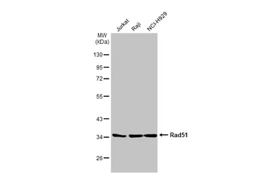Anti-Rad51 antibody [14B4] used in Western Blot (WB). GTX70230