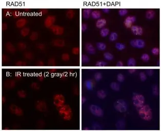 Anti-Rad51 antibody [14B4] used in Immunocytochemistry/ Immunofluorescence (ICC/IF). GTX70230
