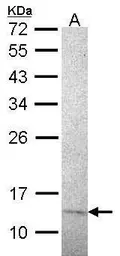 Anti-RPA14 antibody [14.2] used in Western Blot (WB). GTX70240