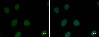 Anti-RPA32 antibody used in Immunocytochemistry/ Immunofluorescence (ICC/IF). GTX70242