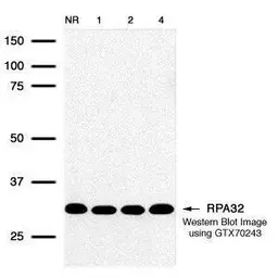 Anti-RPA32 antibody [12F3.3] used in Western Blot (WB). GTX70243