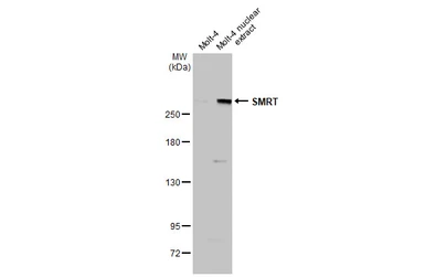 Anti-SMRT antibody used in Western Blot (WB). GTX70245