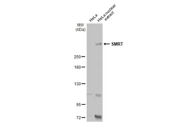 Anti-SMRT antibody [1542] used in Western Blot (WB). GTX70248
