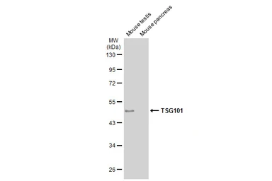 Anti-TSG101 antibody [4A10] used in Western Blot (WB). GTX70255